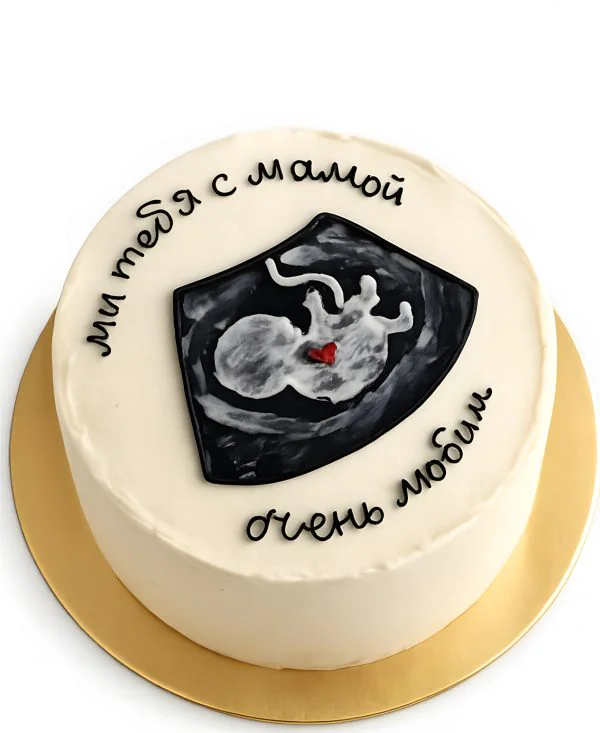 Бенто-торт с рисунком УЗИ Фото